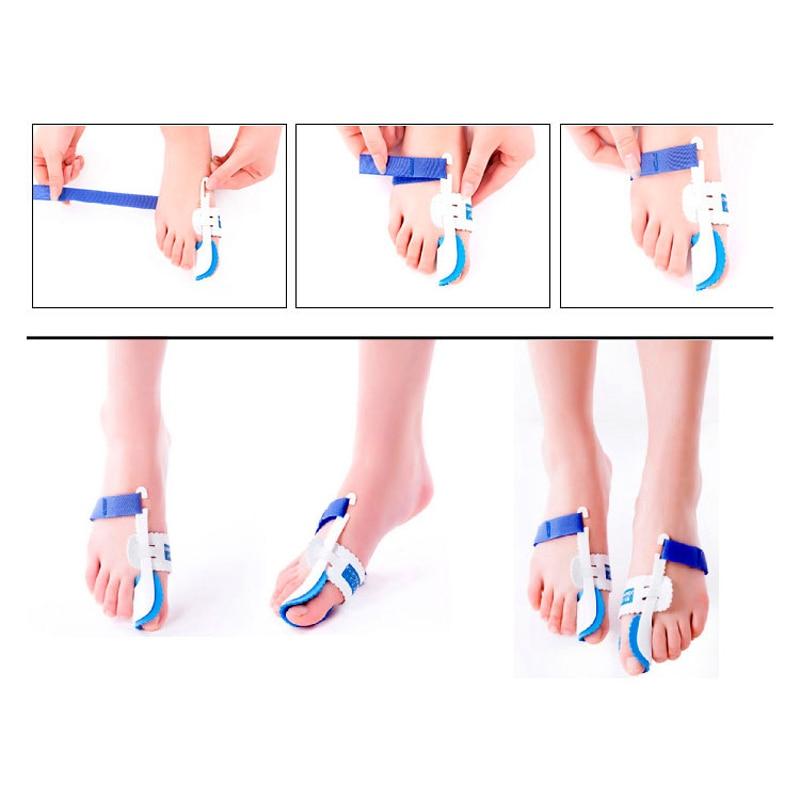 ORTHOPEDIC BUNION CORRECTOR